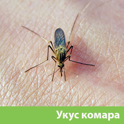 Укусы комаров в Каменске-Уральском