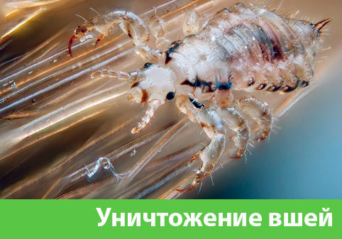 Уничтожение вшей в городе Каменск-Уральский